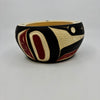Randy Adams Killer Whale Bowl -  - carving Bowl - House of Himwitsa Art Gallery